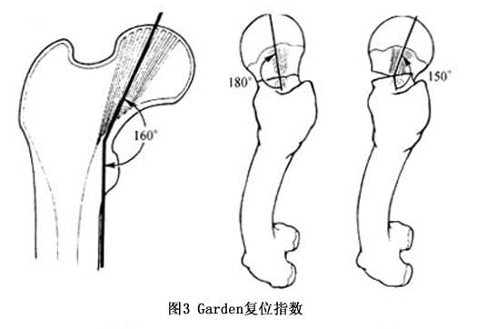 Gxq1ur8a.jpg
