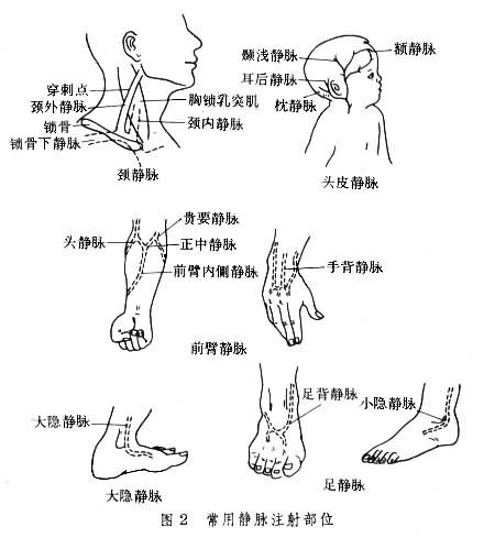 常用静脉注射部位