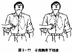 寻找胸骨下切迹