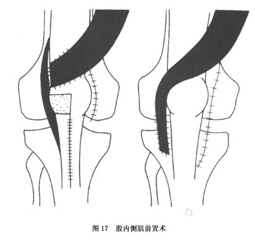 Gxq1hv6s.jpg
