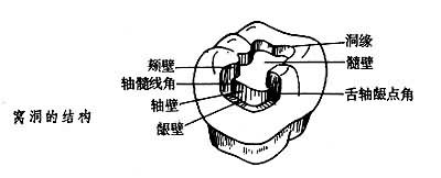 窝洞的结构