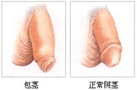 Bkh8a.jpg