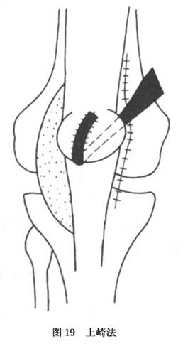 Gxq1iqun.jpg